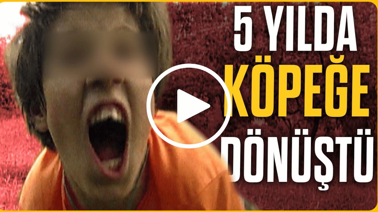 5 Yılda köpeğe dönüşen kız! İnanması zor ama gerçek!